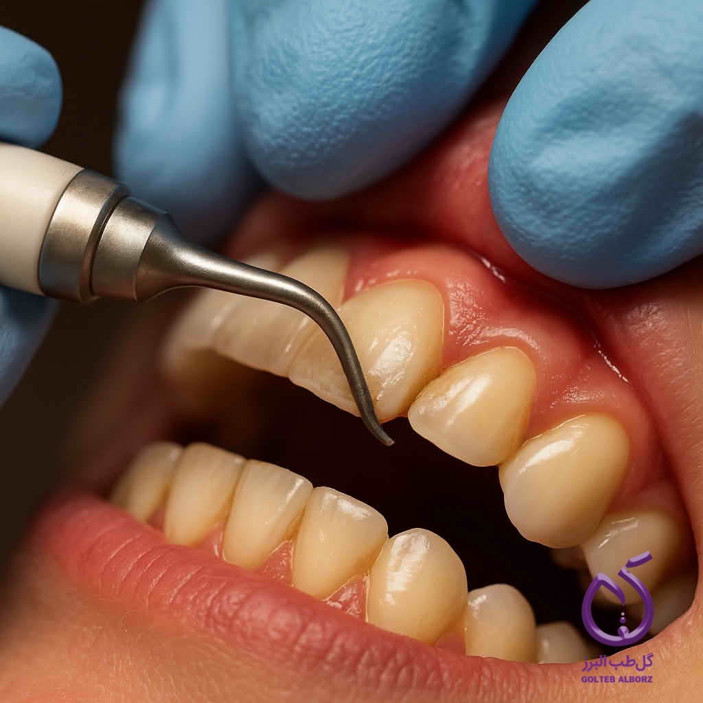 Gum Diseases: Causes, Symptoms, and Treatment Methods for Periodontal Diseases