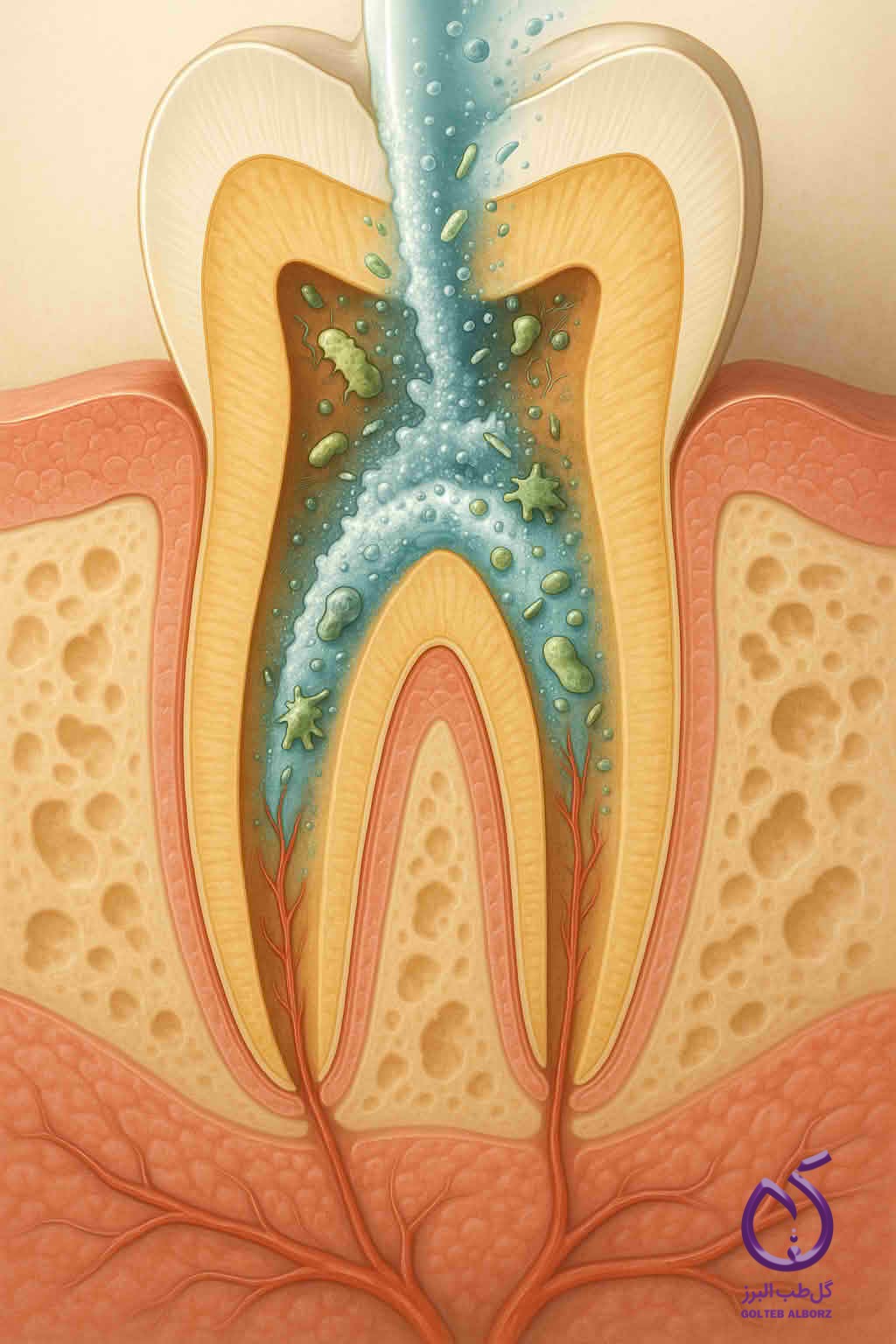 Endodontic irrigants including sodium hypochlorite, EDTA, and chlorhexidine
